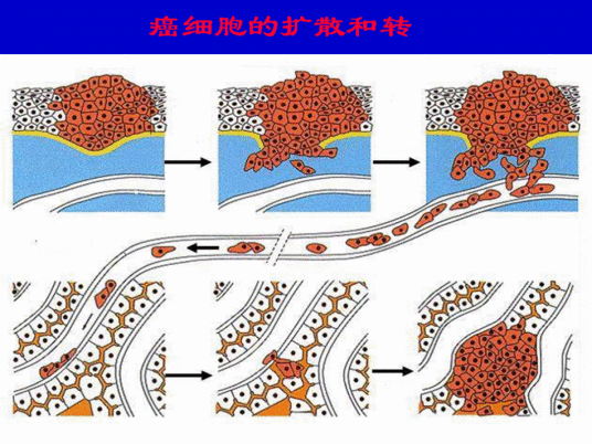 细胞癌变