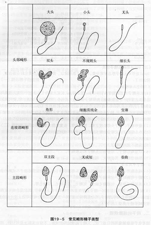 畸形精子症