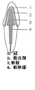 植牙需要多长时间来自，要花多少钱。