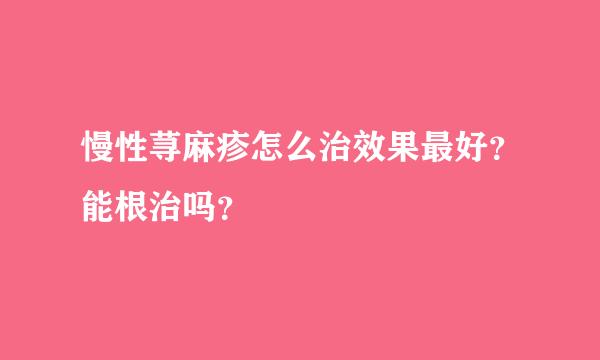 慢性荨麻疹怎么治效果最好？能根治吗？