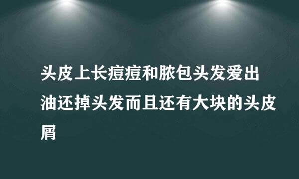 头皮上长痘痘和脓包头发爱出油还掉头发而且还有大块的头皮屑