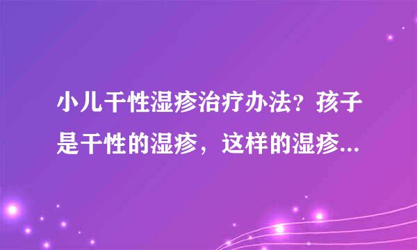 小儿干性湿疹治疗办法？孩子是干性的湿疹，这样的湿疹要怎么治疗最好呢