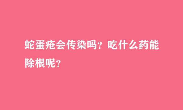 蛇蛋疮会传染吗？吃什么药能除根呢？