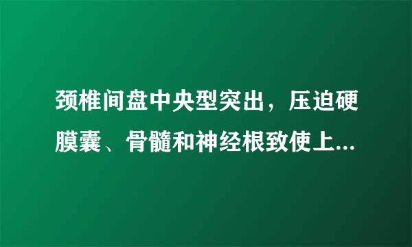 颈椎间盘中央型突出，压迫硬膜囊、骨髓和神经根致使上肢来自麻木胀痛，怎么治疗？