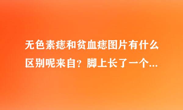 无色素痣和贫血痣图片有什么区别呢来自？脚上长了一个痣，是这几个星期才长的。