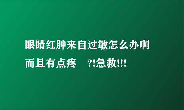 眼睛红肿来自过敏怎么办啊 而且有点疼 ?!急救!!!