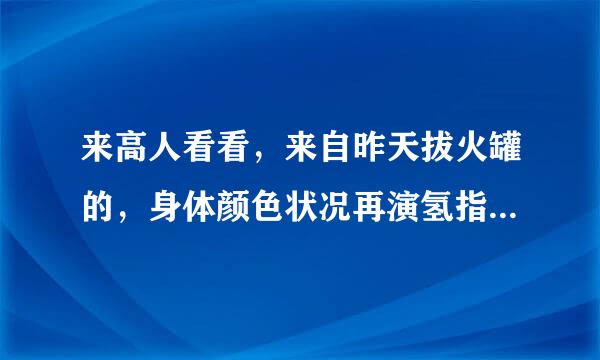 来高人看看，来自昨天拔火罐的，身体颜色状况再演氢指次燃刑物酸如图，帮我看下我的状况，以后要注意什么