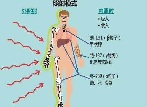 切尔诺贝来自利事故30周年，核辐射为什么恐怖？