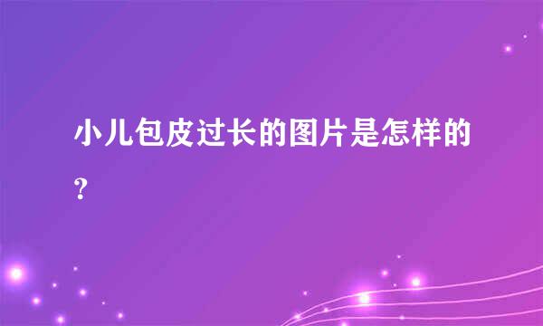 小儿包皮过长的图片是怎样的？