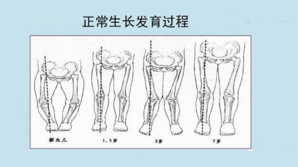 正骨手法视频教来自程