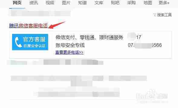 微信有客服电话吗