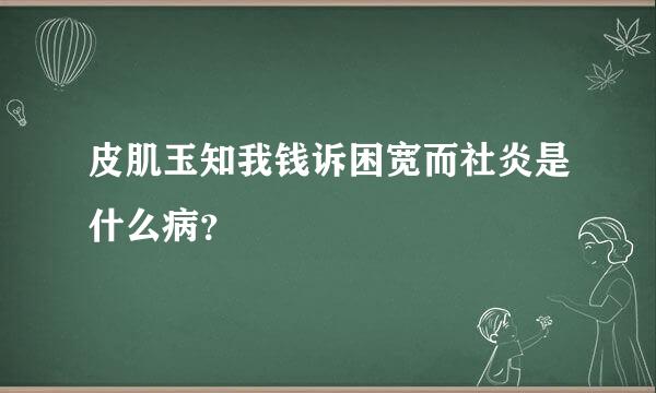 皮肌玉知我钱诉困宽而社炎是什么病？