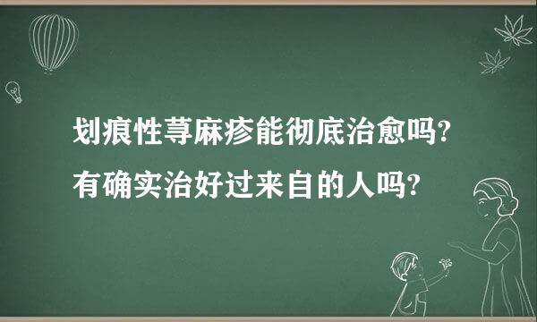 划痕性荨麻疹能彻底治愈吗?有确实治好过来自的人吗?