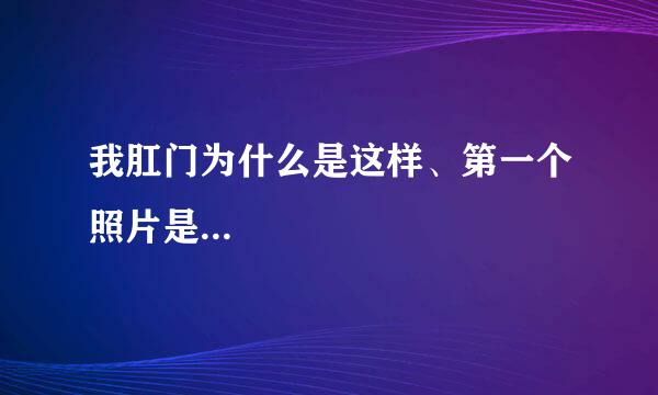 我肛门为什么是这样、第一个照片是...