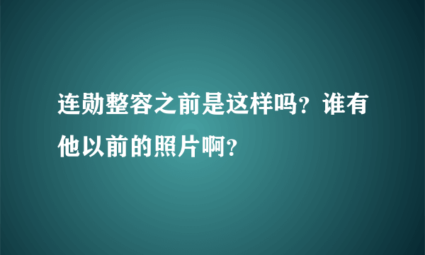 连勋整容之前是这样吗？谁有他以前的照片啊？