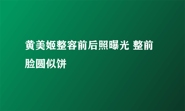 黄美姬整容前后照曝光 整前脸圆似饼