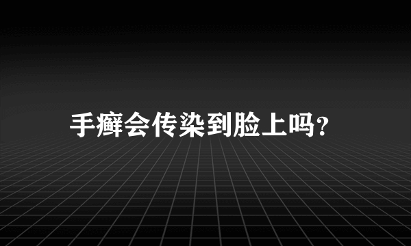 手癣会传染到脸上吗？