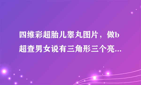 四维彩超胎儿睾丸图片，做b超查男女说有三角形三个亮点,一个蜡烛样的,是