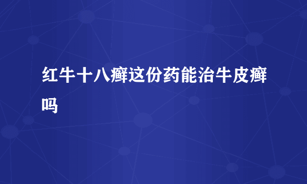 红牛十八癣这份药能治牛皮癣吗