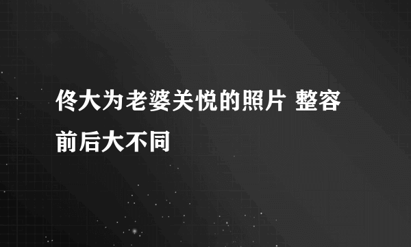 佟大为老婆关悦的照片 整容前后大不同