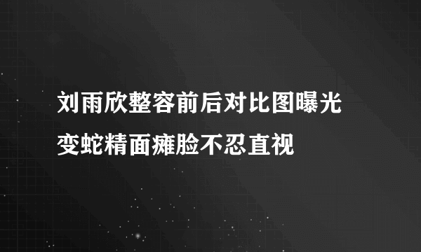 刘雨欣整容前后对比图曝光 变蛇精面瘫脸不忍直视