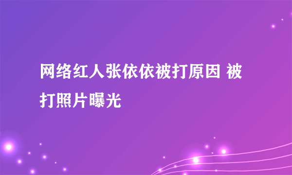 网络红人张依依被打原因 被打照片曝光