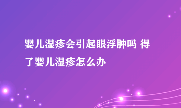 婴儿湿疹会引起眼浮肿吗 得了婴儿湿疹怎么办