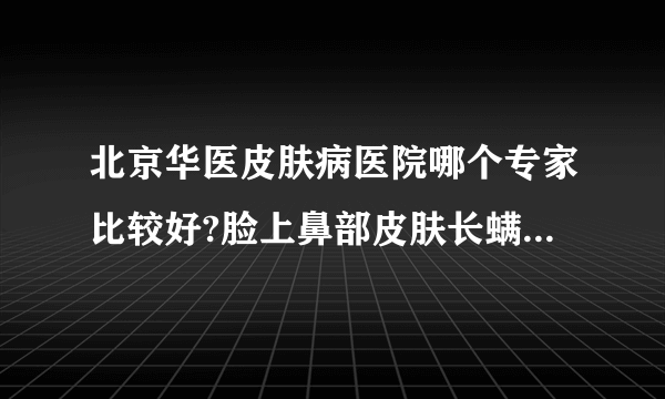 北京华医皮肤病医院哪个专家比较好?脸上鼻部皮肤长螨虫怎么去除