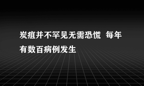 炭疽并不罕见无需恐慌  每年有数百病例发生