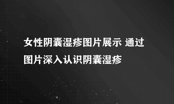 女性阴囊湿疹图片展示 通过图片深入认识阴囊湿疹