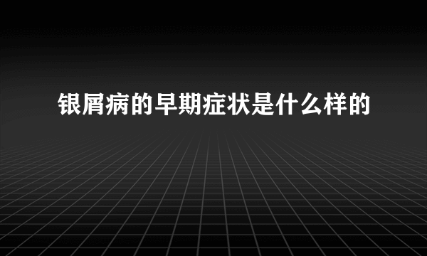 银屑病的早期症状是什么样的