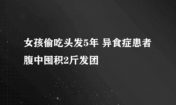 女孩偷吃头发5年 异食症患者腹中囤积2斤发团