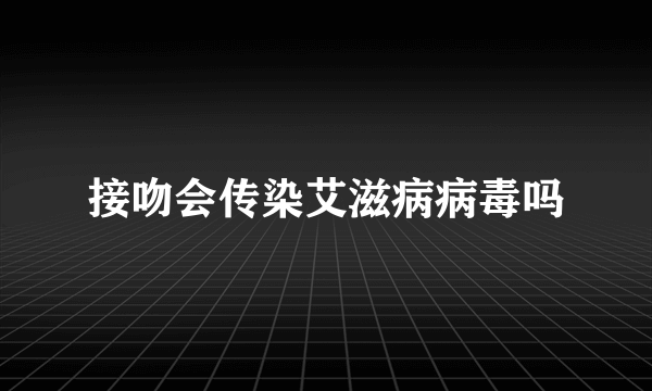 接吻会传染艾滋病病毒吗